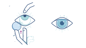 Regardez vers le haut et posez délicatement la lentille sur...